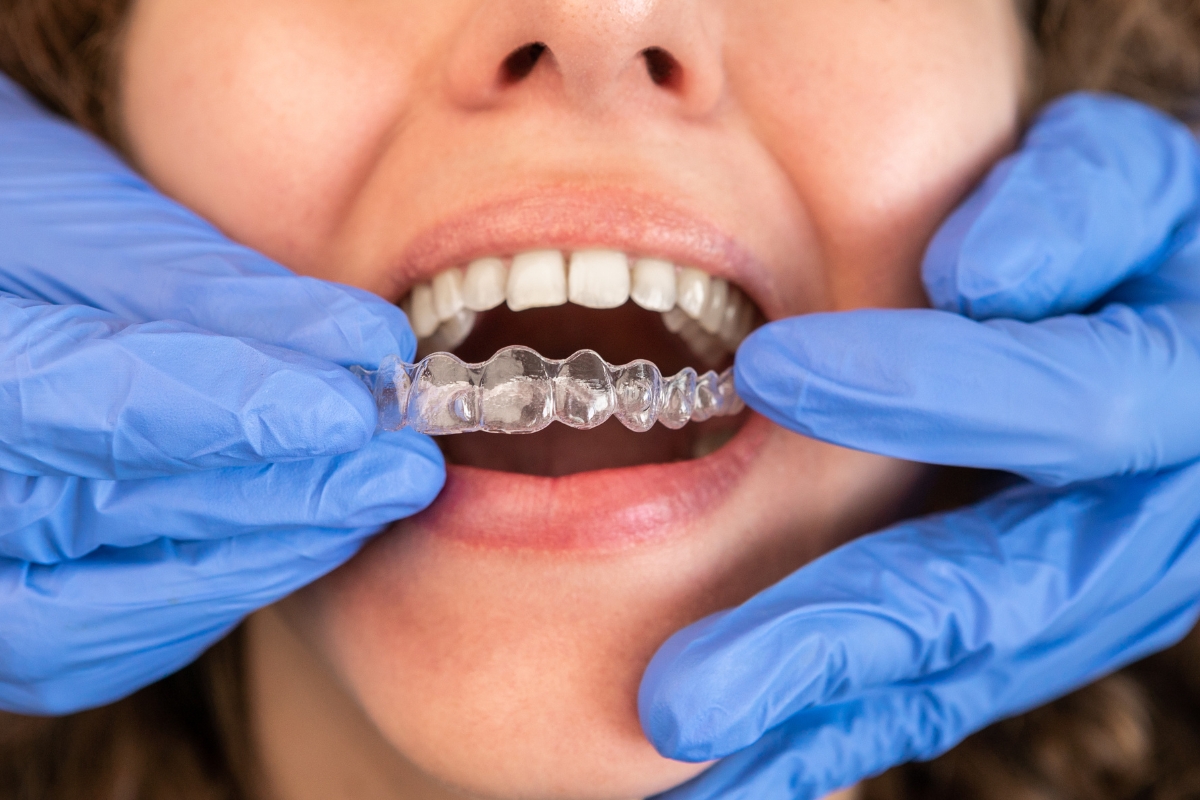 HRD_Invisalign (1200 x 800)