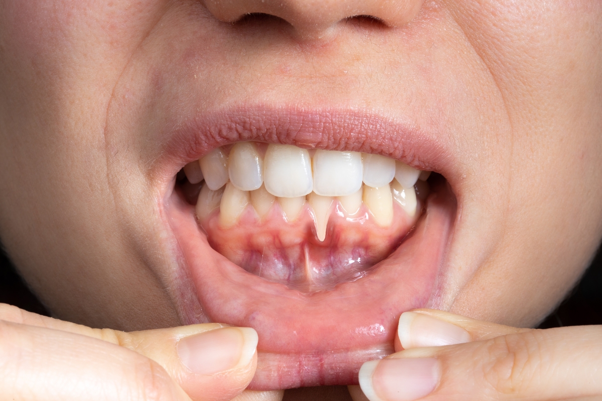 HRD_Periodontics (1200 x 800) (1)